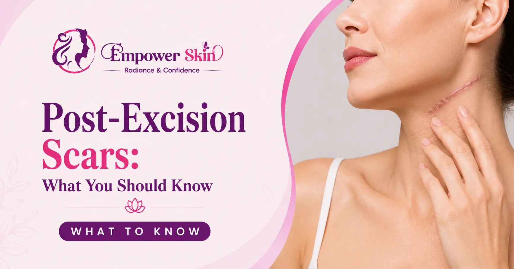 Post-Excision Scars: What You Should Know