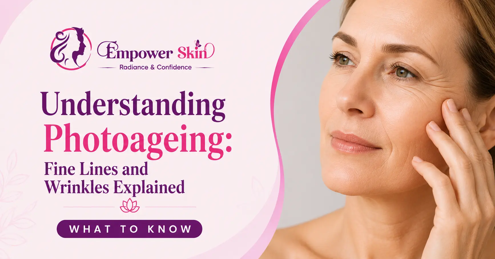 Understanding Photoageing: Fine Lines and Wrinkles Explained