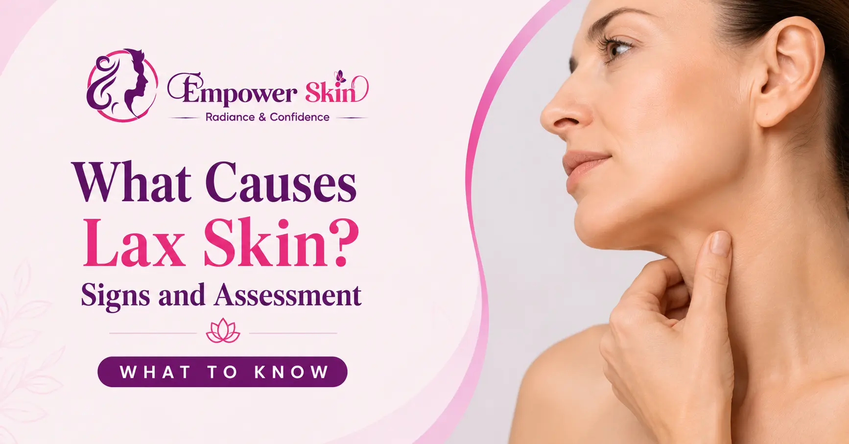 What Causes Lax Skin? Signs and Assessment